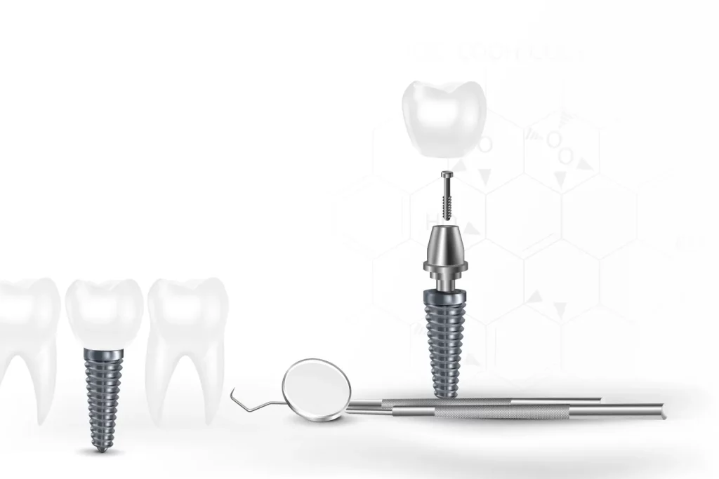Implante Dental Descompuesto