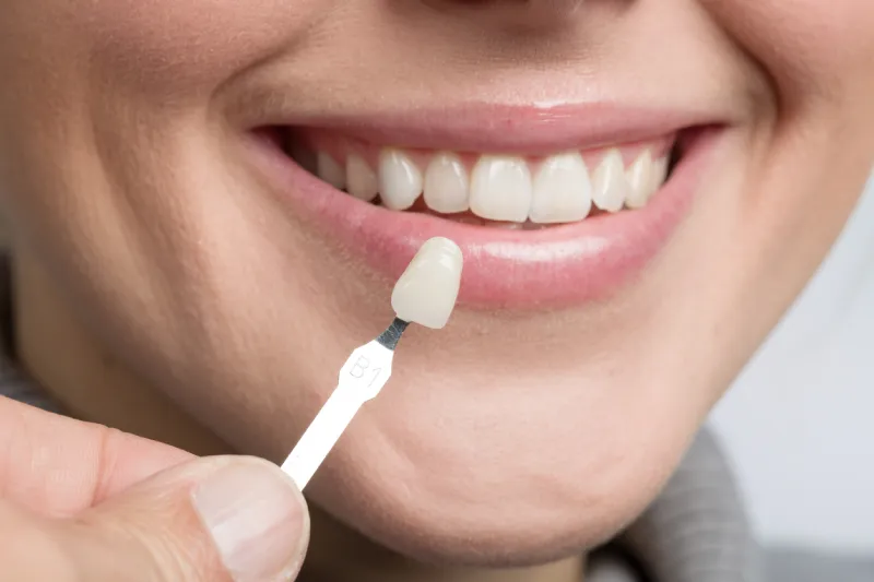mujer sonriendo con muestra de carillas dentales